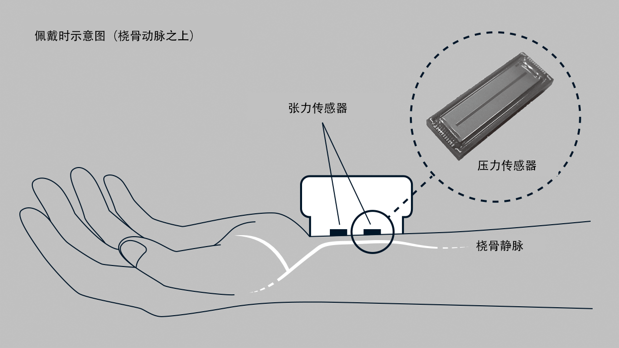 手首に機器をつけるだけで1拍ごとの血圧を測定できる、オムロン独自の圧力センサー